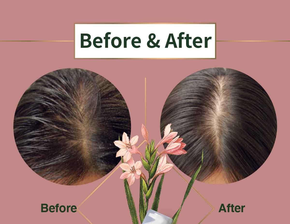 Before After Dry Shampoo